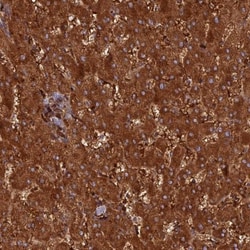 HHAT Antibody, Novus Biologicals:Antibodies:Primary Antibodies